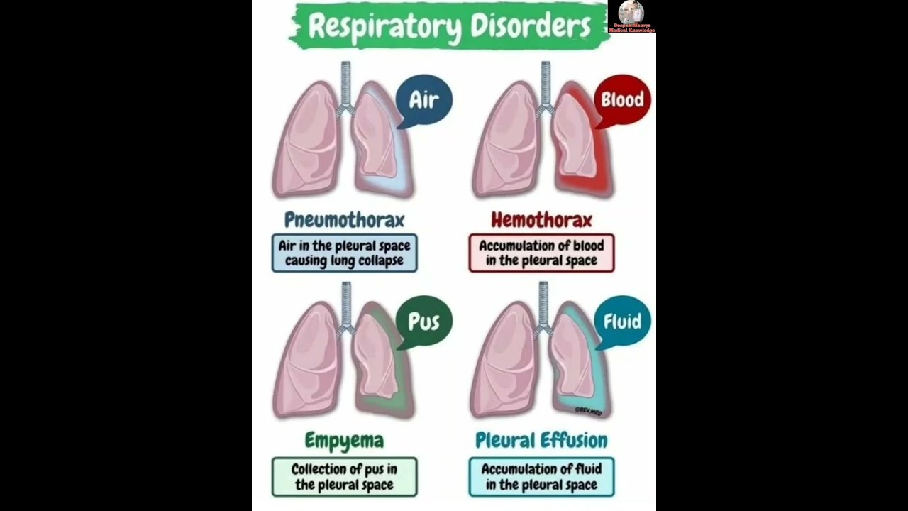 Picture Pneumothorax Hemothorax
