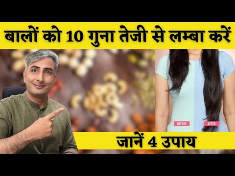 बालों को तेजी से बढ़ाने के लिए क्या करना चाहिए? जानें 4 उपाय I DR. MANOJ DAS #drmanojdas