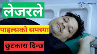 पायल्स सम्बन्धी रोगमा लेजर विधि Piles operation latest technology II Laser clinic Pokhara