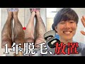 【ケノン】1年間毎週脱毛、その後６ヶ月放置した結果。#家庭用脱毛器 #効果検証