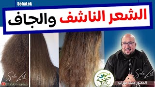 وصفات للشعر الناشف وصفة لترطيب الشعر / imad dr mizab cheveux