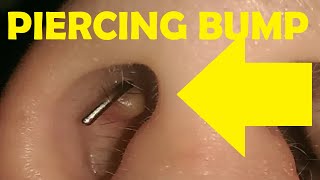 how to get rid of a piercing bump inside nose