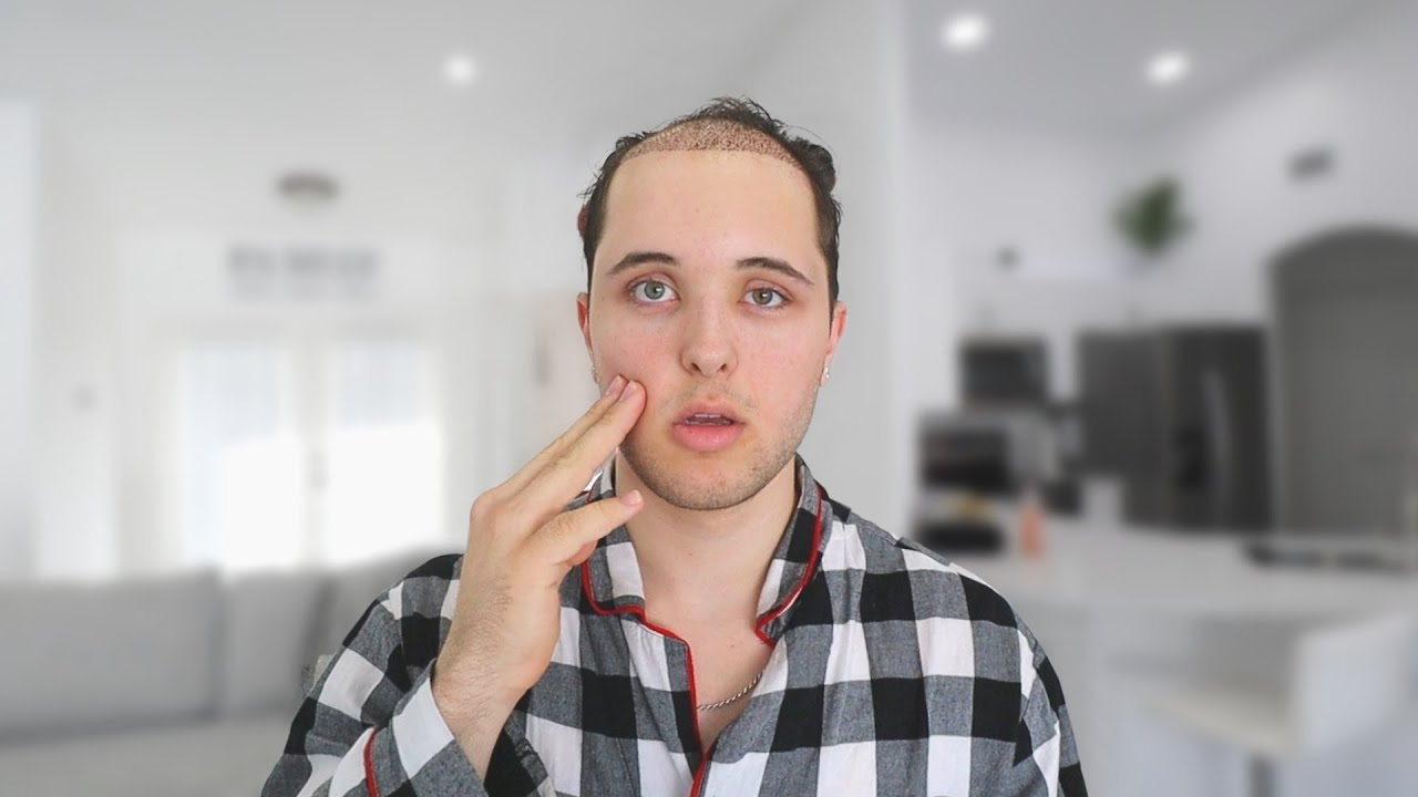 Why Has One Side Of My Dogs Face Swelled Up