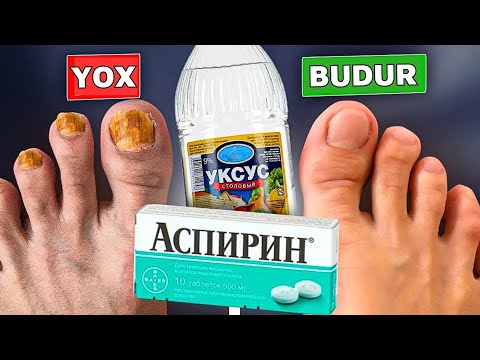 Video: Ağac və çömbəlmə ayaqları böyüdəcəkmi?