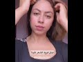 لبنات و صفة خطيرة للقشرة في الشعر
