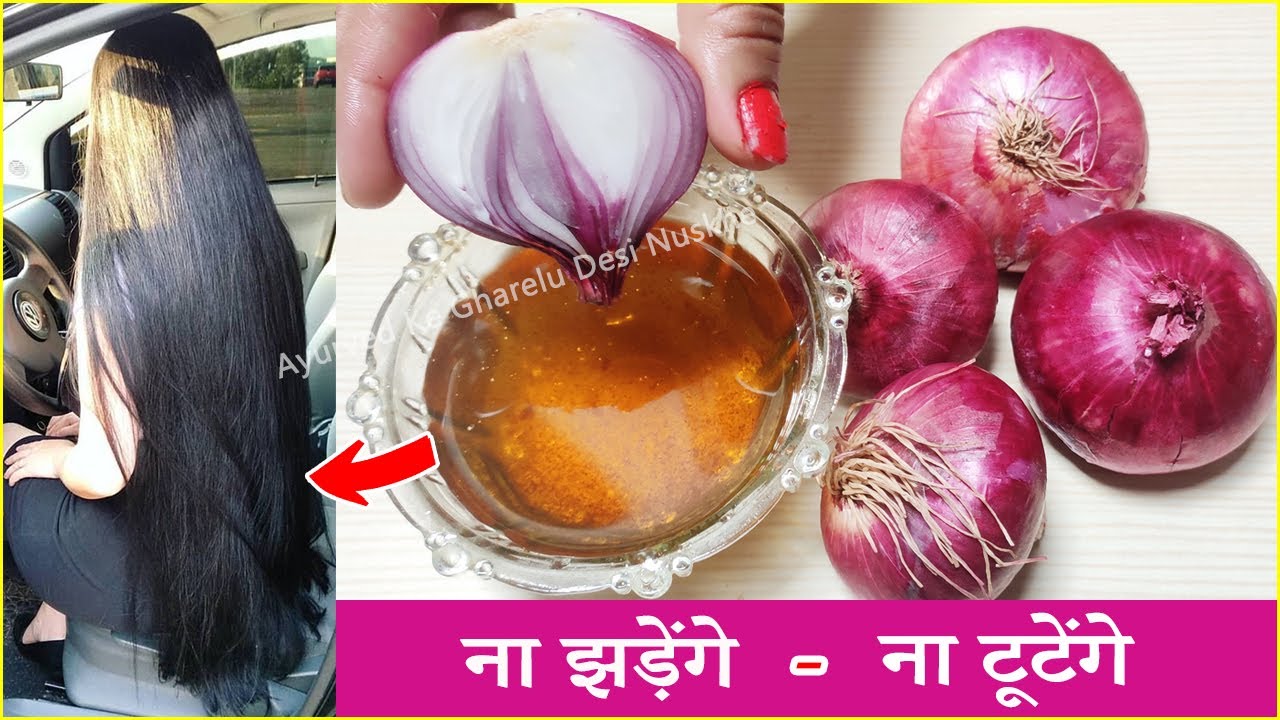 ONION HAIR OIL for faster hair growth, Balo ke liye Pyaj ka tel प्याज