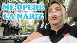 ME OPERÉ LA NARIZ / CIRUGÍA DE NARIZ / Lalo Villar