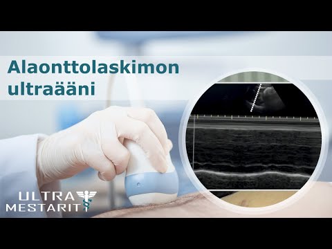 Video: Elbona-Ultra - Ohjeet Jauheen Käytöstä, Arvostelut, Hinta, Analogit