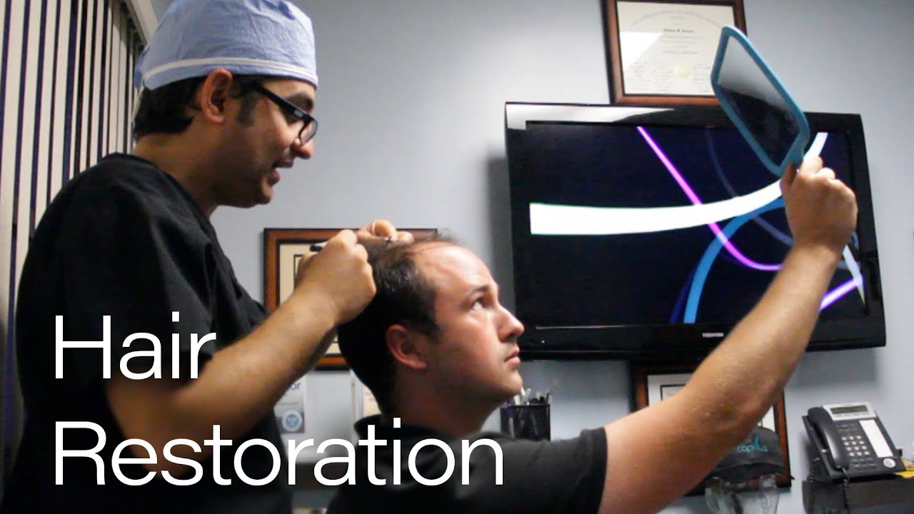 GOING GOING GONE - Episode 1 - Hair Restoration
