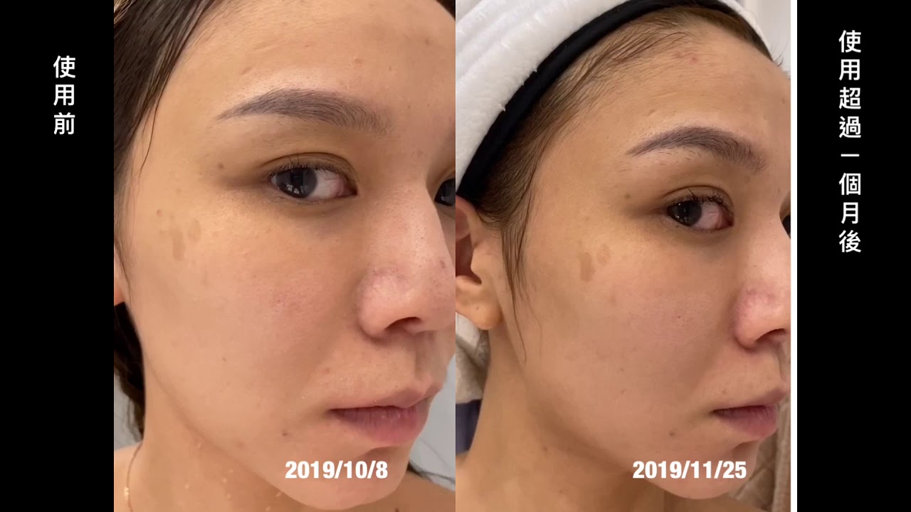 為什麼我停用皙之密了 無修圖無濾鏡無效棄坑使用心得紀錄 Kimmy Fun 痞客邦