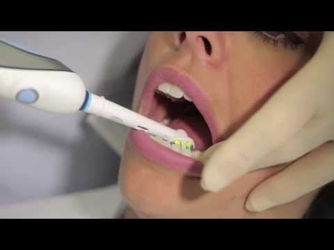 Video: Berus Gigi Helluva: Oral B Crossaction - Matador Network