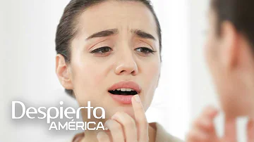 ¿Qué té elimina el herpes labial?