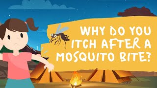 #KidZone - Why do you Itch after a Mosquito Bite?