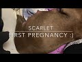 Scarlets first pregnancy!! / pit bull birth