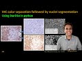 282 -  IHC color separation followed by nuclei segmentation using StarDist in python