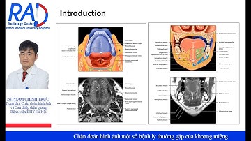 Chẩn đoán hình ảnh một số bệnh lý thường gặp của khoang miệng