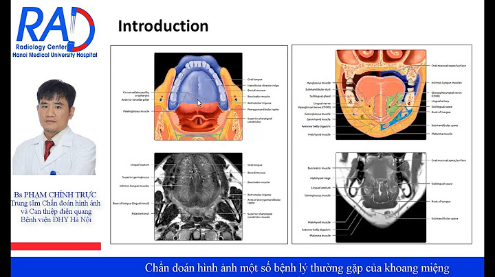 Dấu hiệu ung thư khoang miệng