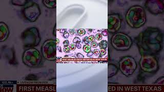 BREAKING: FIRST MEASLES DEATH REPORTED IN TEXAS