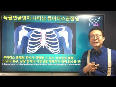 늑골연골염이 나타난 류마티스관절염 Costochondritis & Rheumatoid Arthritis