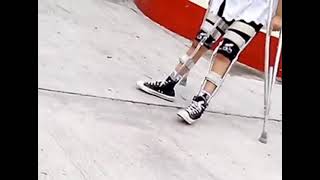 Polio Girl Walking With Braces And Crutches.