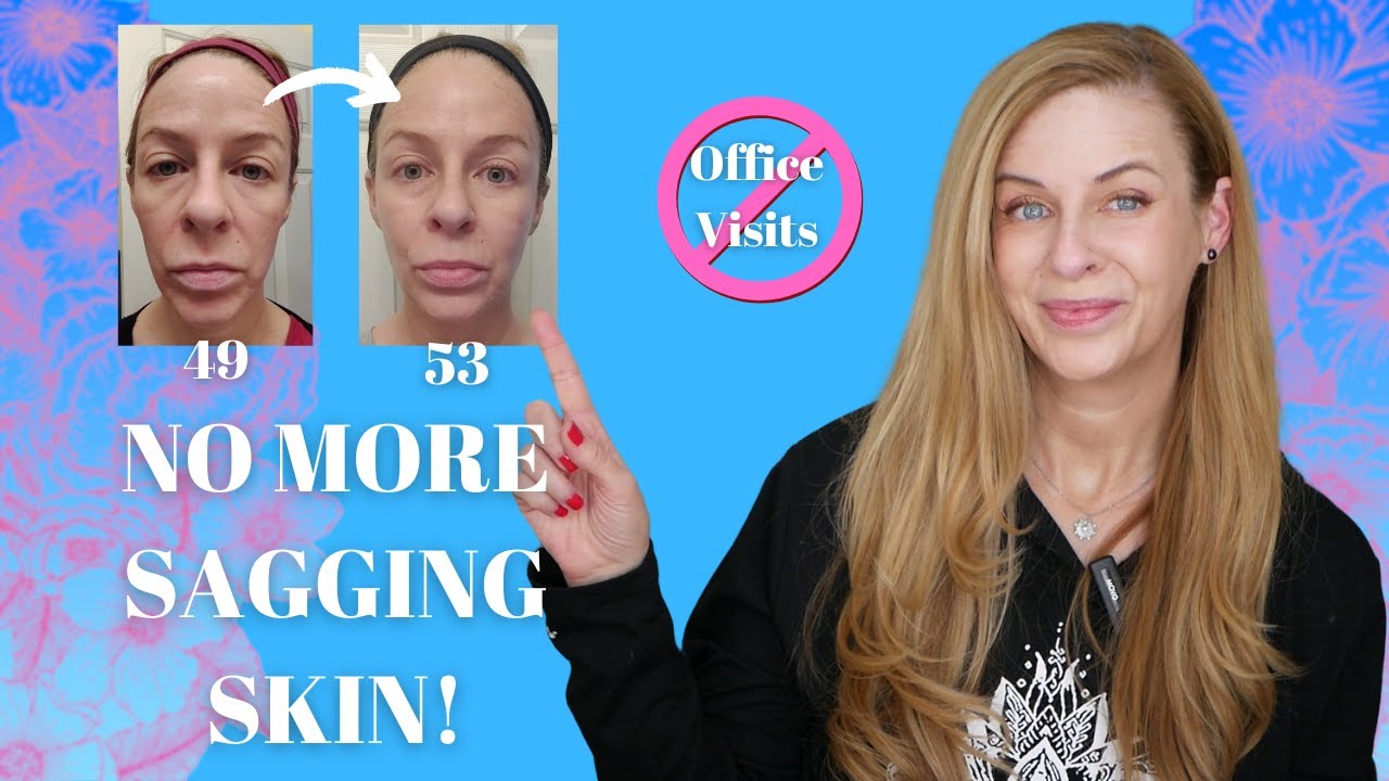 How I Fixed My Sagging Jowls Without Surgery! - YouTube