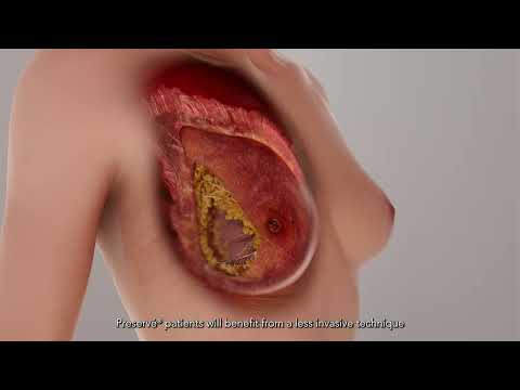 How Preservé® Works