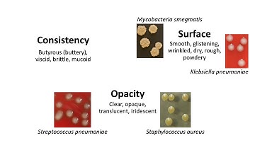 Level 2 Microbiology & Immunology | Microbiological Examination of River Water (Colony Morphology)