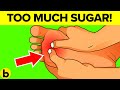 8 Warning Signs That You Are Eating Too Much Sugar