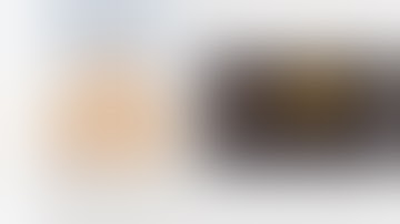 Permacath Insertion in Right IJV || Chronic Kidney Disease || Dialysis Access || Vascular Surgery