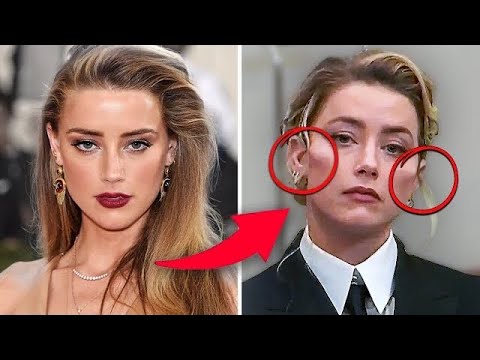 What “Happened” to Amber Heard’s Cheeks? Plastic Surgery Update