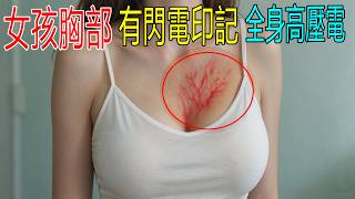 女孩胸口有閃電標記，自帶高壓電，一輩子只能電人 100 次