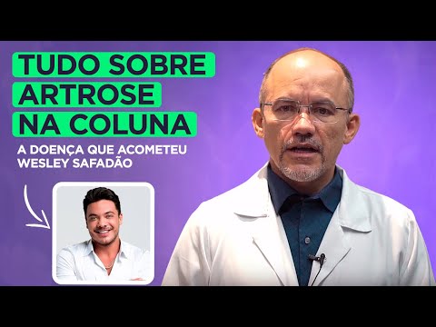 Artrose na Coluna: Saiba tudo com Neurocirurgião!