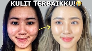 TOP 10 Rekomendasi Moisturizer / Pelembab Wardah Terbaik Untuk Kulit Berminyak dan Berjerawat