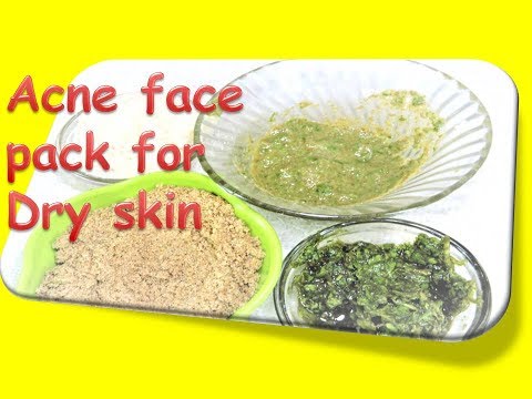 Rid of Pimples/Acne fast from Dry skin - Acne face pack for Dry skin in Hindi