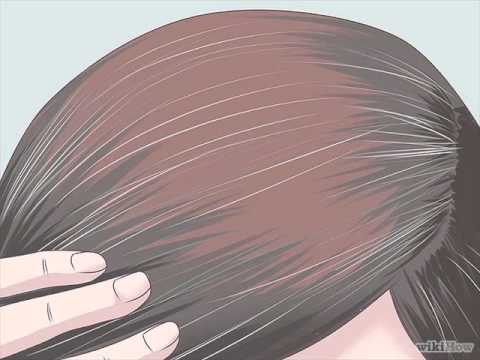 Tips How To Get Rid Of White Hair In Teenage Fast Youtube