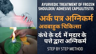 Arka patra agnikarma || frozen shoulder ayurvedic treatment || Agnikarma for frozen shoulder