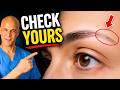What Your Eyebrows May Be Trying to Tell You | Dr. Mandell