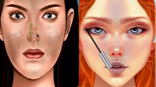 Asmr Nose Blackheads Remove Treatment Without Pain