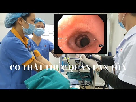 Video Hình ảnh co thắt thực quản lan tỏa trên nội soi dạ dày - youtube
