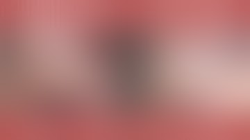 Combo MIGS x 2 And Phaco: Streamline + Hydrus with Eyhance Lens Implant