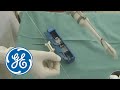 Tru-Cut Biopsy in Gynecologic Oncology | GE Healthcare