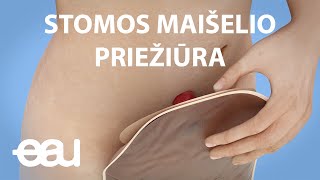 STOMOS MAIŠELIO PRIEŽIŪRA (Stoma Bag Lithuanian)