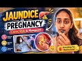 Jaundice in Pregnancy 😳 | Nursing Management You MUST Know | Norcet 2026