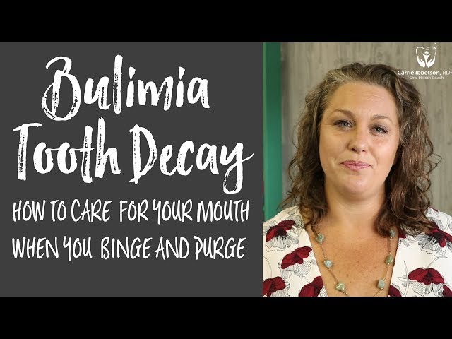 Bulimia Tooth Decay - Take Care of your Mouth when you are Binging and Purging class=