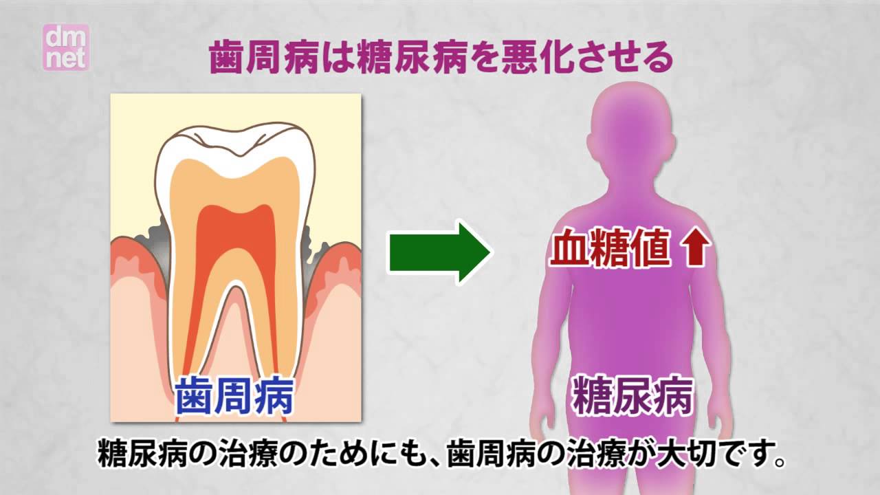 5-10. 糖尿病と歯周病【糖尿病3分間ラーニング】 - YouTube