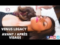 Avantaprs  visage  venus legacy