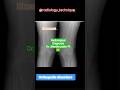 #Rediological Diagnosis #Noramal and abnormal #diagnosis #X,ray #Dr. Jitendra yadav Pt 👉 #examine ✅