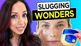 I Tried Slugging For 90 Days! Eye Doctor Explains