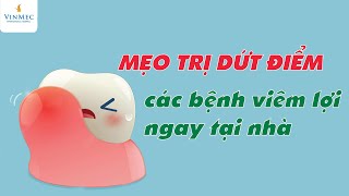 Top 12 Cách Làm Giảm Sưng Khi Bị Đau Răng Đặc Sắc Nhất Năm 2022