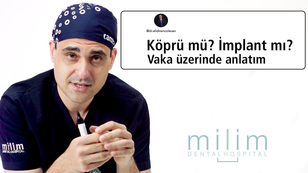 Köprü mü, İmplant mı? Komplike Bir Vaka Üzerinden Değerlendiriyoruz
